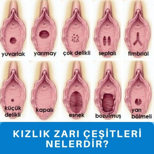 Kalıcı Geçici Bekaret İstanbul Kızlık Zarı dikimi himenoplasti hymenoplasti hymenoplasty nedir nasıl nerede yapılır tamiri onarımı kanı kanaması muayenesi bozulması zedelenmesi yırtılması belirtileri İstanbul Avrupa Anadolu yakası dikişi ameliyatı 2019 2020 2021 2022 fiyatları fiyatı himenoplasti hymenoplasti hymenoplasty 2019 2020 2021 2022 İstanbul Avrupa Anadolu ne kadar nedir yapılır anlaşılır mı İstanbul Avrupa yakası Anadolu yakası Tekirdağ Mecidiyeköy Maslak Levent kadınlar kulübü 2019 2020 2021 2022 Gizli Edirne Taksim Aksaray Adalar Arnavutköy Ataşehir Avcılar Bağcılar Bahçelievler Bakırköy Başakşehir Bayrampaşa Beşiktaş Beykoz Beylikdüzü Beyoğlu Büyükçekmece Çatalca Çekmeköy Esenler Esenyurt Eyüpsultan Fatih Gaziosmanpaşa Güngören Kadıköy Kağıthane Kartal Küçükçekmece Maltepe Pendik Sancaktepe Sarıyer Silivri Sultanbeyli Sultangazi Şile Şişli Tuzla Ümraniye Üsküdar Zeytinburnu Acıbadem Gizli Nişantaşı Gebze Bolu Yalova Özel hastane Devlet hastanesi anestezisiz lokal genel anestezi ile anestezili Bekar Kızlık zarı dikimi fiyatları, fiyatı, ücreti, ücretleri yapan yerler doktorlar hastaneler hastanesi merkezler merkezi klinikler kliniği Kızlık zarı dikimi dikişi tamiri onarımı fiyatları Kalıcı Geçici Bekaret İstanbul Kızlık Zarı dikimi himenoplasti hymenoplasti hymenoplasty nedir nasıl nerede yapılır tamiri onarımı kanı kanaması muayenesi bozulması zedelenmesi yırtılması belirtileri İstanbul Avrupa Anadolu yakası dikişi ameliyatı 2019 2020 2021 2022 fiyatları fiyatı himenoplasti hymenoplasti hymenoplasty 2019 2020 2021 2022 İstanbul Avrupa Anadolu ne kadar nedir yapılır anlaşılır mı İstanbul Avrupa yakası Anadolu yakası Tekirdağ Mecidiyeköy Maslak Levent kadınlar kulübü 2019 2020 2021 2022 Gizli Edirne Taksim Aksaray Adalar Arnavutköy Ataşehir Avcılar Bağcılar Bahçelievler Bakırköy Başakşehir Bayrampaşa Beşiktaş Beykoz Beylikdüzü Beyoğlu Büyükçekmece Çatalca Çekmeköy Esenler Esenyurt Eyüpsultan Fatih Gaziosmanpaşa Güngören Kadıköy Kağıthane Kartal Küçükçekmece Maltepe Pendik Sancaktepe Sarıyer Silivri Sultanbeyli Sultangazi Şile Şişli Tuzla Ümraniye Üsküdar Zeytinburnu Acıbadem Gizli Nişantaşı Gebze Bolu Yalova Özel hastane Devlet hastanesi anestezisiz lokal genel anestezi ile anestezili Bekar Kızlık zarı dikimi fiyatları, fiyatı, ücreti, ücretleri yapan yerler doktorlar hastaneler hastanesi merkezler merkezi klinikler kliniği Kızlık zarı dikimi dikişi tamiri onarımı fiyatları
